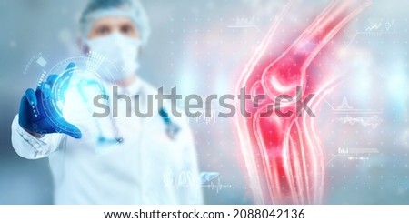 The doctor looks at a hologram of a sore knee, severe pain. X-ray image, trauma, rheumatologist consultation, skeletal image, medical concept, medical technologies of the future, pain when walking Royalty-Free Stock Photo #2088042136