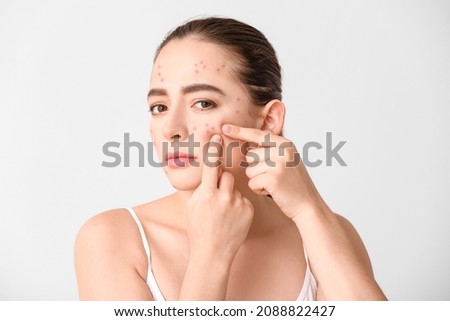 Young woman with acne problem squishing pimples on white background Royalty-Free Stock Photo #2088822427