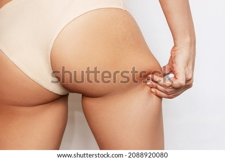 Cropped shot of a young woman grabbing skin on her thigh with excess fat isolated on a white background. Pinching the loose and saggy muscles. The problem of breeches on the hips. Taking care of body
