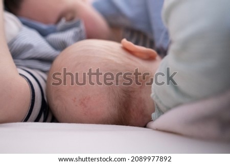 Bald spot on the back of the infant baby head. Rubbed hair of the toddler child Royalty-Free Stock Photo #2089977892