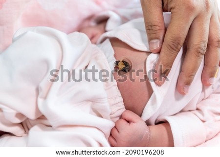 The mother's hand is placed on the body of a 7-day-old baby newborn, to expose the baby's umbilical cord, to children and health baby newborn concept. Royalty-Free Stock Photo #2090196208