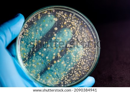 Backgrounds of Characteristics and Different shaped Colony of Bacteria and Mold growing on agar plates from Soil samples for education in Microbiology laboratory.
 Royalty-Free Stock Photo #2090384941