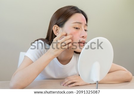 Dermatology, puberty asian young woman, girl looking into mirror, allergy presenting an allergic reaction from cosmetic, red spot or  rash on face. Beauty care from skin problem by medical treatment. Royalty-Free Stock Photo #2091325087