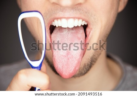white covered and coated tongue out with tiny bumps is indicator for sickness and infections and reason for bad breath and smell but can be cleaned by tongue coating cleaner by scraping the white foam Royalty-Free Stock Photo #2091493516