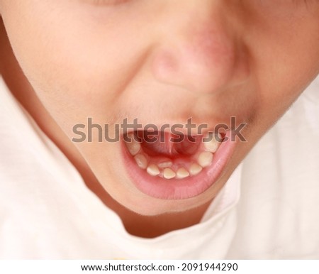 The child's molars are erupting when the milk teeth have not yet fallen out. Anomaly. Close-up