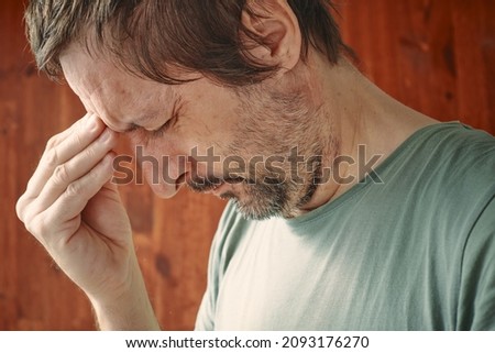 Thunderclap headache concept, man feeling sudden pain in forehead Royalty-Free Stock Photo #2093176270