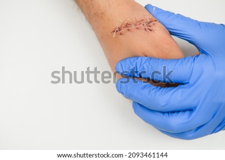 examination by a doctor of a cut on the arm