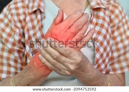 Pain in the hand of Southeast Asian elder woman. Concept of hand pain, arthritis, rheumatism and tendon problems. Royalty-Free Stock Photo #2094753592