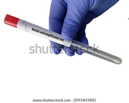 Nasal swab from patients for nucleic acids amplification test, RNA SARS-CoV-2 virus coding genes, detection of coronavirus Royalty-Free Stock Photo #2095843885