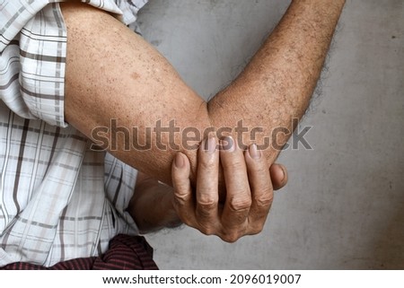 Pain in the elbow joint of Southeast Asian elder man. Concept of elbow pain, rheumatoid arthritis and arm problems.