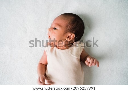 Newborn little baby girl with angels kiss birthmark on the forehead