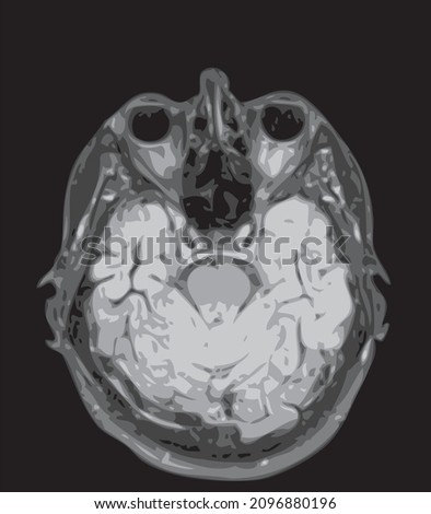 mri of the brain of an adult male on a black background