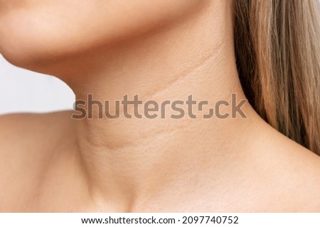 Сlose-up of a young blonde woman's neck  on a white background. Lines on the neck. Wrinkles, age-related changes, rings of Venus, goosebumps. Skin care Royalty-Free Stock Photo #2097740752