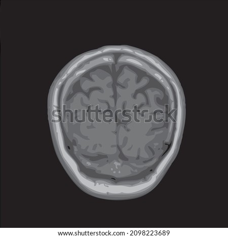 mri of the brain of an adult male on a black background