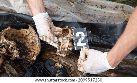 A police officer or military medical examiner examines a decomposed human remains. Work in silicone gloves at the crime scene. Royalty-Free Stock Photo #2099517250