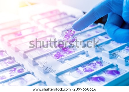 Hand in blue glove holding glass histology slides Royalty-Free Stock Photo #2099658616