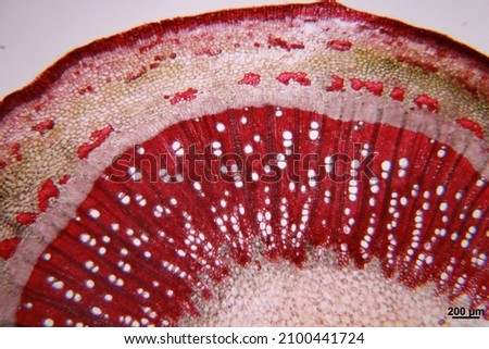 This picture is a cross section of stem plant tissue and under a light microscope. 
Found in many types of plant tissues, such as ground tissue (parenchyma cell, collenchyma cell, sclerenchyma)