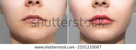 Closeup of female lips after permanent makeup lip blushing procedure Royalty-Free Stock Photo #2101210087