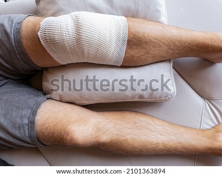 CLOSE UP: Detailed shot of a man's legs and his bandaged knee after surgery. Male patient's knee in home care is wrapped in bandages after a meniscus surgery. Man is recovering after knee surgery. Royalty-Free Stock Photo #2101363894