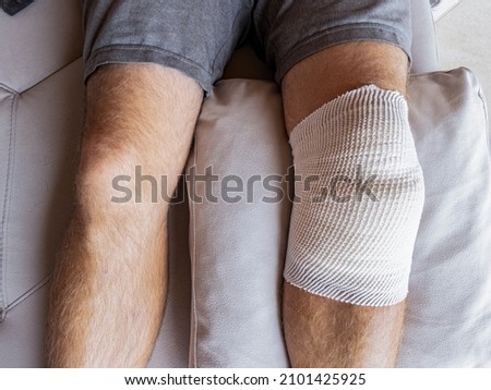 CLOSE UP: Male patient's knee in home care is wrapped in bandages after a meniscus surgery. Detailed shot of a man's legs and his bandaged knee after surgery. Man is recovering after knee surgery. Royalty-Free Stock Photo #2101425925