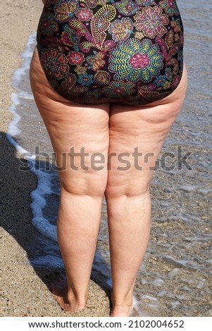 legs of a curvy woman with cellulite in a swimsuit, back view close-up