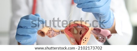Gynecologist shows how to ligate the fallopian tubes on training model of female reproductive system. Laparoscopic tubal ligation concept Royalty-Free Stock Photo #2102173702