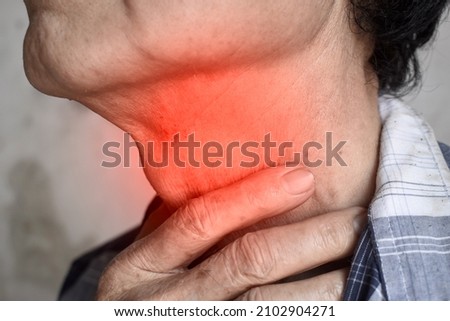 Redness at neck of Asian old man. Concept of sore throat, pharyngitis, laryngitis or dysphagia. Royalty-Free Stock Photo #2102904271