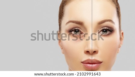 Lower  Blepharoplasty. plastic surgery concept. Royalty-Free Stock Photo #2102991643