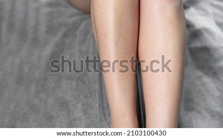 Image before and after concept of hair removal on female legs in a beauty salon. Baner. copy space.
