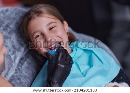 mouth guard - myofunctional trainer to eliminates mouth breathing habit, helps equalize the growing teeth and correct bite. mouthguard in the mouth of a girl close-up. A device for leveling teeth. Royalty-Free Stock Photo #2104201130