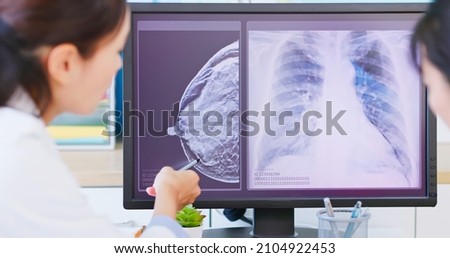 close up of asian woman has breast cancer diagnosis in hospital - female doctor showing mammography test results and xray to patient on computer