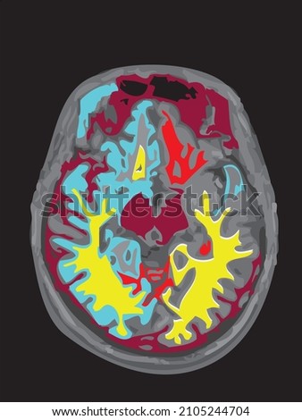 colorful mri of the brain of an adult male on a black background