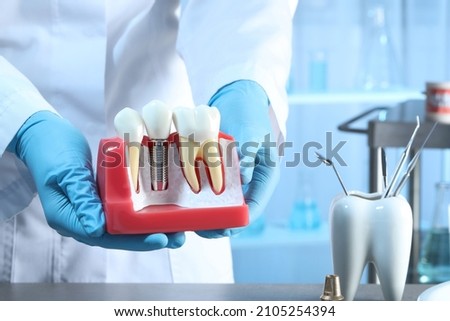 Dentist holding educational model of gum with dental implant between teeth indoors, closeup Royalty-Free Stock Photo #2105254394