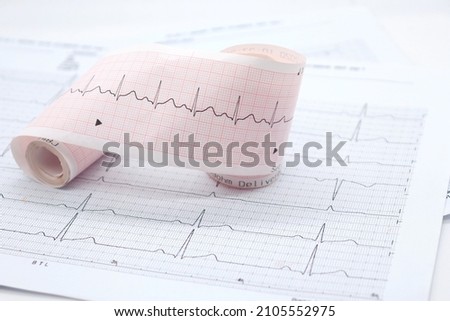 heart rhythm ekg note on paper Doctors use it to analyze heart disease treatments. illustration on a white background Royalty-Free Stock Photo #2105552975