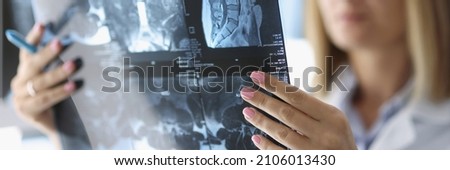 Close-up of professional female doctor analyze x ray of patients back. Smart medical worker in cabinet. Planned checkup at clinic. Medicine and healthcare concept