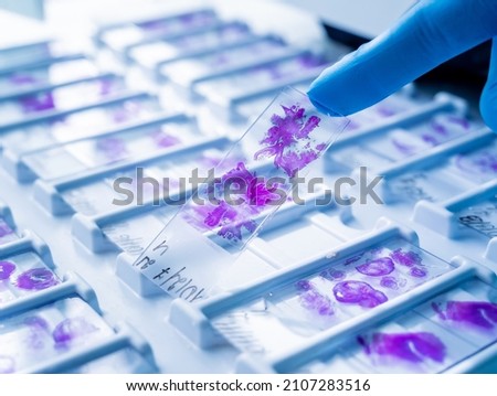 Hand in blue glove holding glass histology slides Royalty-Free Stock Photo #2107283516