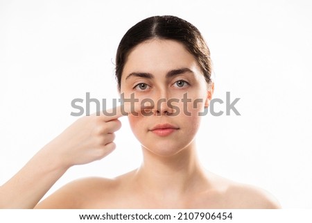 Plastic nose surgery. Portrait of young caucasian woman point her crooked bridge of the nose isolated on white background. Copy space. Concept of rhinoplasty. Royalty-Free Stock Photo #2107906454