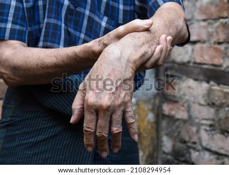 Radial nerve injury or wrist drop of Asian elder man. Royalty-Free Stock Photo #2108294954