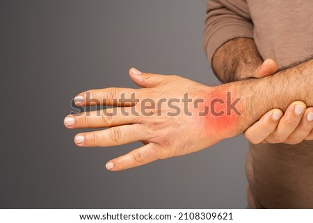 Joint diseases or joint inflammation Royalty-Free Stock Photo #2108309621