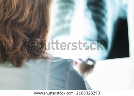 x-ray, asthma check, doctor with lung picture in medical clinic