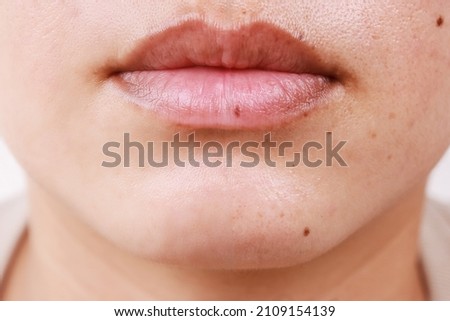 medical treatment  freckles spots on the face and mouth female brown dermatologist  Royalty-Free Stock Photo #2109154139