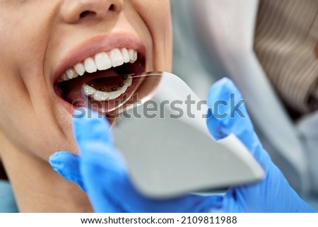 Close-up of orthodontist examining lingual braces of female patient with a mirror during dental check-up. Royalty-Free Stock Photo #2109811988