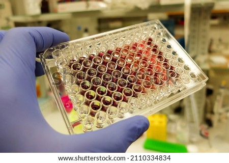 A laboratory technician wearing blue nitrile gloves is holding a 96-well plate that was used to conduct cytotoxicity MTT assay on cultured cancer cells. Royalty-Free Stock Photo #2110334834