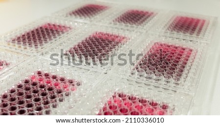 A panel of multiwell culture plates with cancer cells subjected to drug treatment for anticancer activity evaluation using MTT assay. Differences in color indicate varying drug activity. Royalty-Free Stock Photo #2110336010