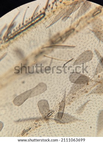 closeup photo of mosquito parts under the microscope