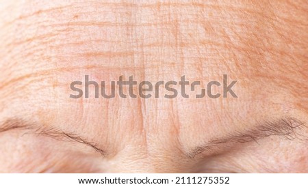 Wrinkled skin of a mature woman's forehead macro photography. Deep aging wrinkles close up. Prevention of age-related skin changes concept. Cosmetology procedures against aging and wrinkles concept. Royalty-Free Stock Photo #2111275352