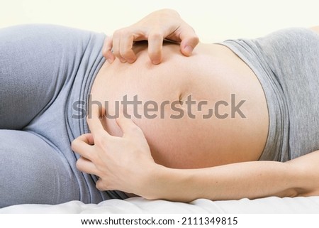 Pregnant woman scratching belly because itchy skin which causes striped- Pregnancy medicine concept. Royalty-Free Stock Photo #2111349815
