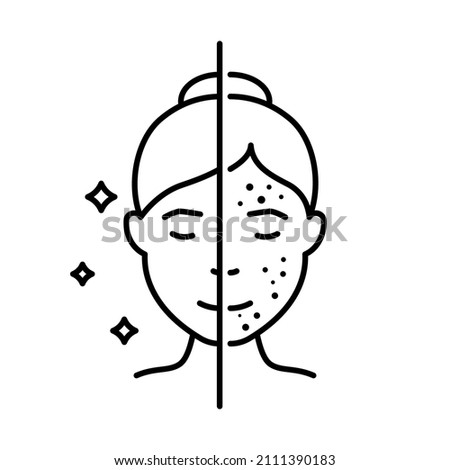Woman with Acne and Clean Face Skin Line Icon. Girl Before and After Skin Treatment Linear Pictogram. Female Skincare for Cleansing Face Outline Icon. Editable Stroke. Isolated Vector Illustration. Royalty-Free Stock Photo #2111390183
