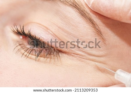 Injection at spa salon. Doctor hands in gloves. Closeup. Pretty female patient. Beauty treatment. Healthy skin procedure. Young women face. Plasmolifting rejuvenation Royalty-Free Stock Photo #2113209353