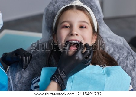 caucasian little kid girl invisible aligner and pointing to her perfect straight teeth. Dental healthcare and confidence concept. Royalty-Free Stock Photo #2115491732